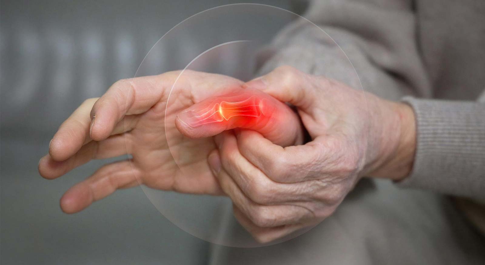 Rheumatoide Arthritis und Colitis ulcerosa verstehen